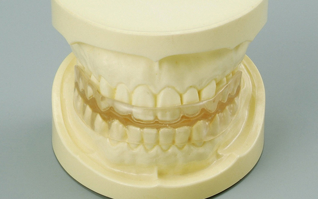 上下一体型マウスピース