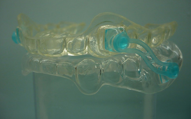 上下分離型マウスピース